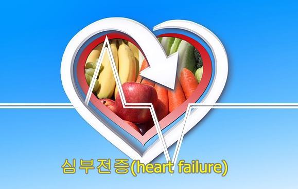 심장질환 심부전증(heart failure)