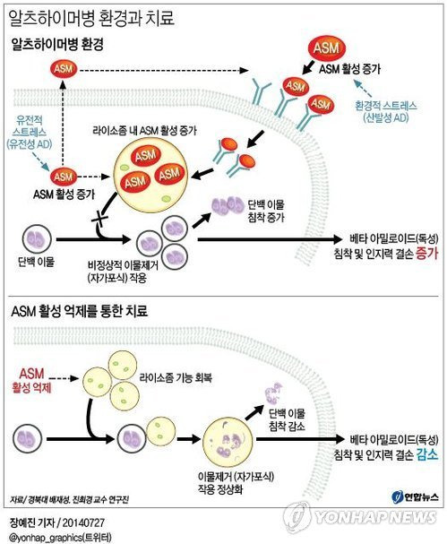 ＜그래픽＞ 알츠하이머병 환경과 치료  'Alzheimer'