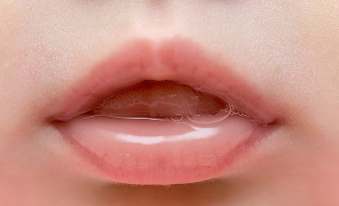 입속의 침으로 알수있는 건강상태 7가지