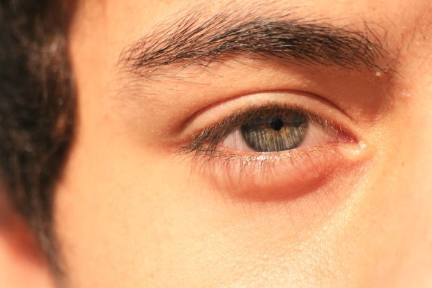 눈떨림 현상과 이유! 눈떨림 증상에 대한 치료법!