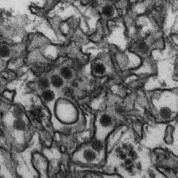 [바이러스] 지카바이러스 증상과 지카바이러스 위험국가
