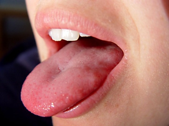 입술과 혀로 알아보는 건강법