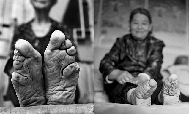 옛 중국 미녀(?)의 기준 '전족(纏足) 풍속' 마지막 세대들 The last living Chinese women with bound feet more than 100 years