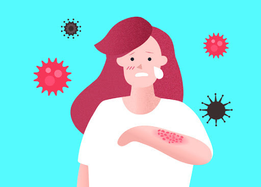 대상포진도 예방할수 있는 우리몸의 면역력 증강 방법