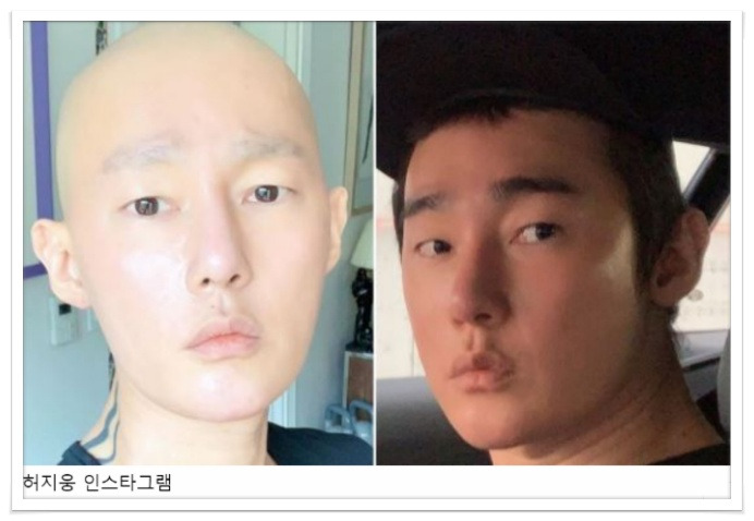 혈액암 완치한 허지웅이 전한 말