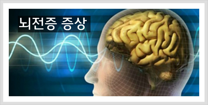 뇌전증 증상