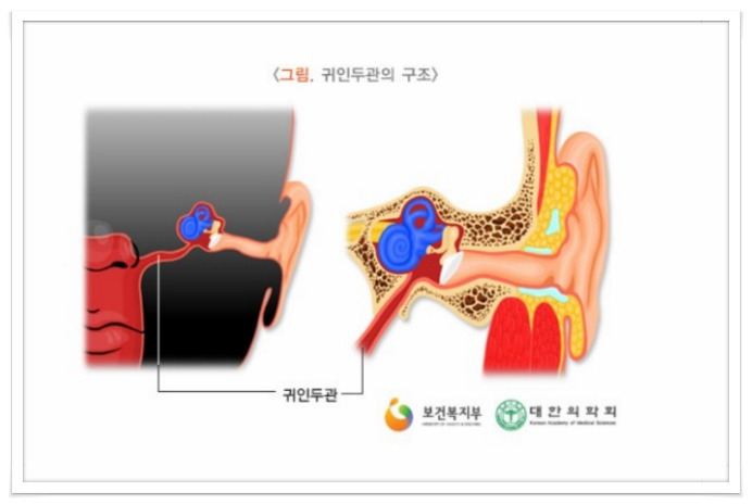 급성중이염, 중이염의 증상