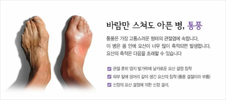 귀족병 황제병 통풍