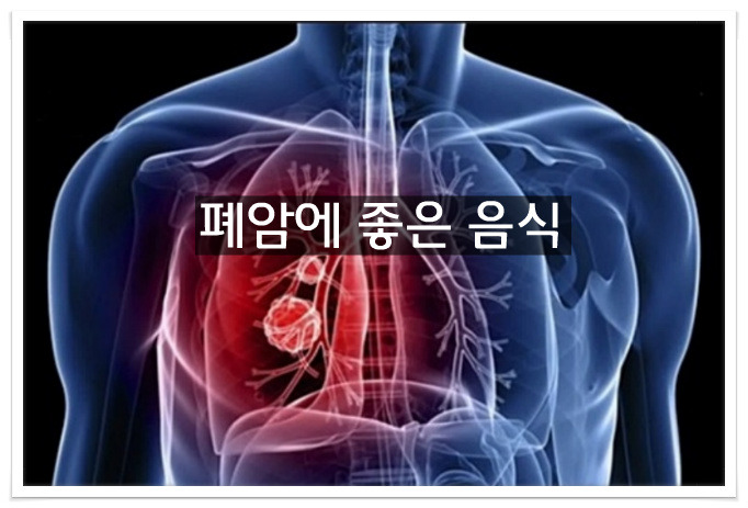 폐암에 좋은음식