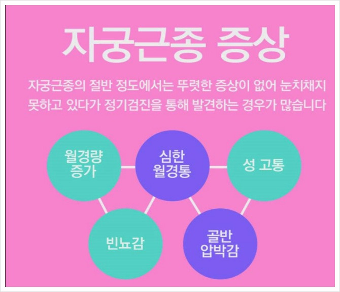 자궁근종 증상.치료