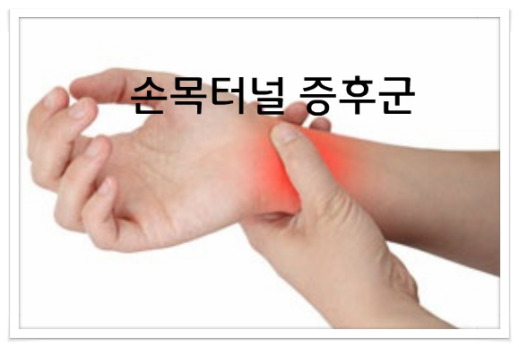 손목터널증후군,손목터널증후군손목보호대