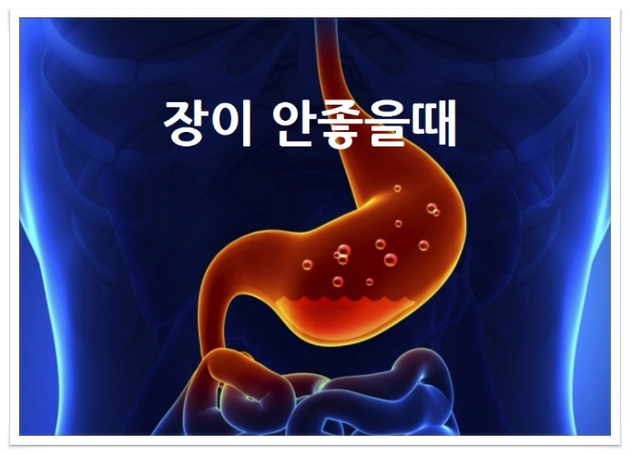 장인안좋을때, 장염증상, 장염빨리낫는법