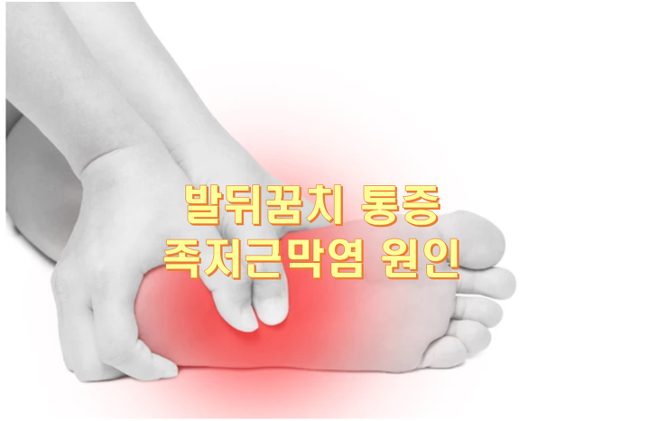 발뒤꿈치 통증 이대로 방치하면 족저 근막염 원인