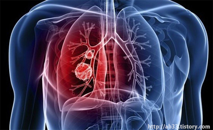 당신의 폐가 망가지고 있다는 신호 10가지