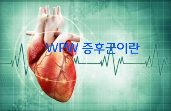 wpw 증후군이란