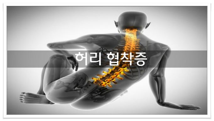 허리협착증