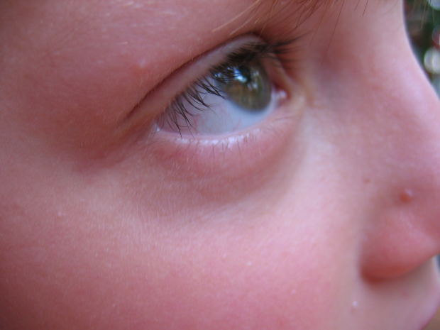 눈떨림 원인이 마그네슘 부족일까? 오래 지속된다면 안면경련증 의심