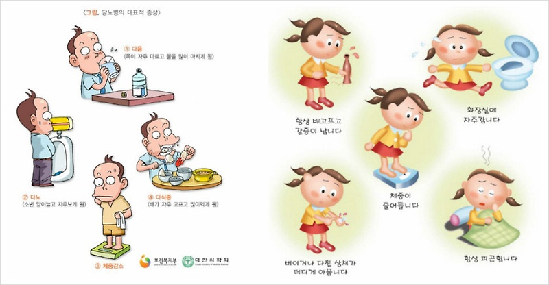 당뇨초기증상