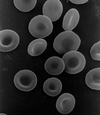 [일본 애니메이션]일하는 세포(はたらく細胞) 1화(폐렴구균(Streptococcus pneumoniae)