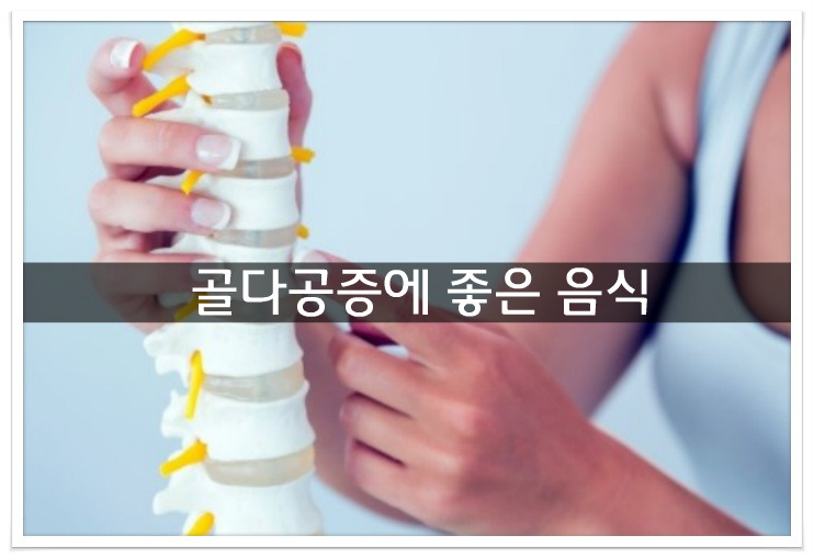 좋다공증에 좋은음식