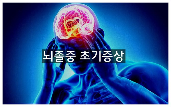 뇌혈관 질환으로 인한 뇌졸중(뇌졸증) 초기증상