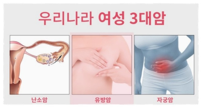 유방암초기증상
