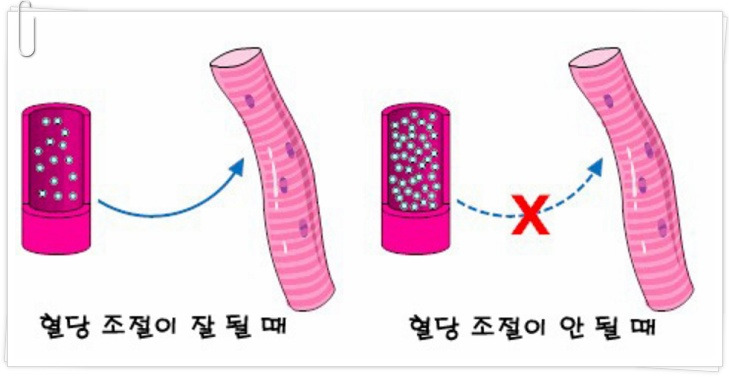 당뇨초기증상 당뇨에좋은음식