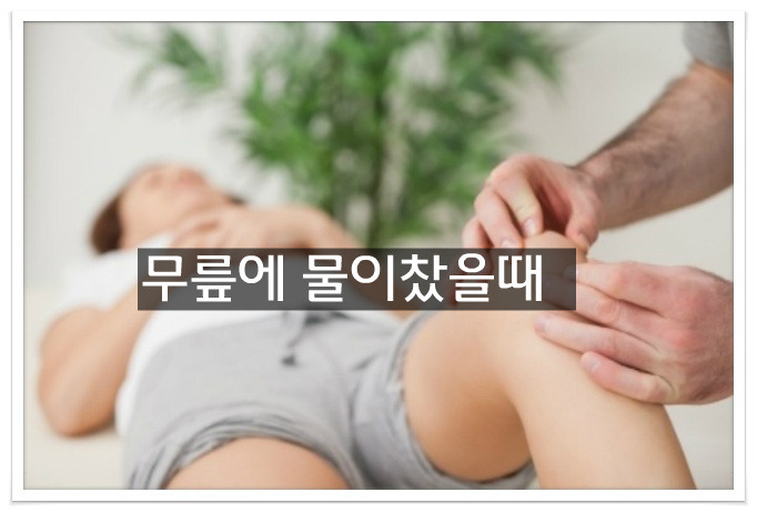 무릎에 물이찼을때