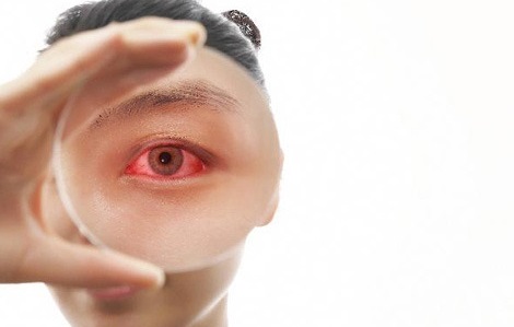 여름철에 잘 걸리는 5대 질환 눈병 원인과 치료