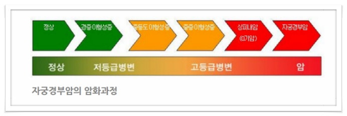 자궁경부암 초기 증상