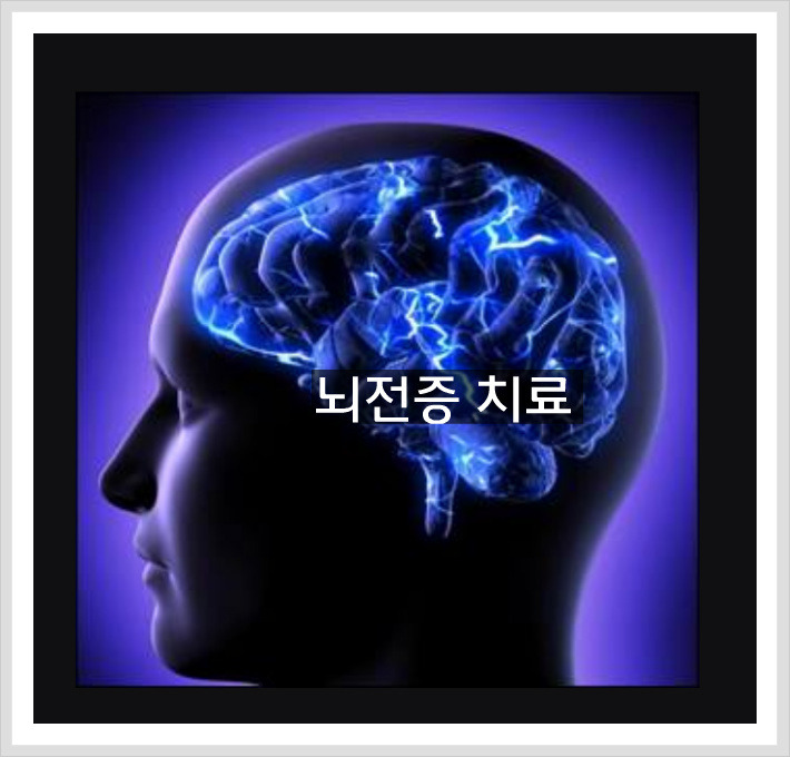 뇌전증 약물치료