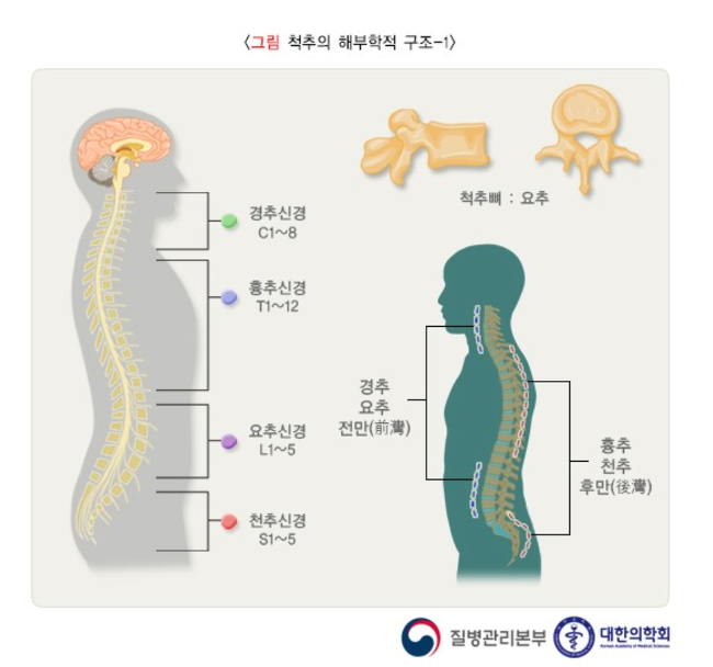 허리요통,만성요통,급성요통