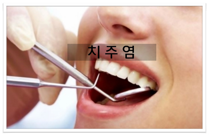 치주염 치주질환을 방치하면