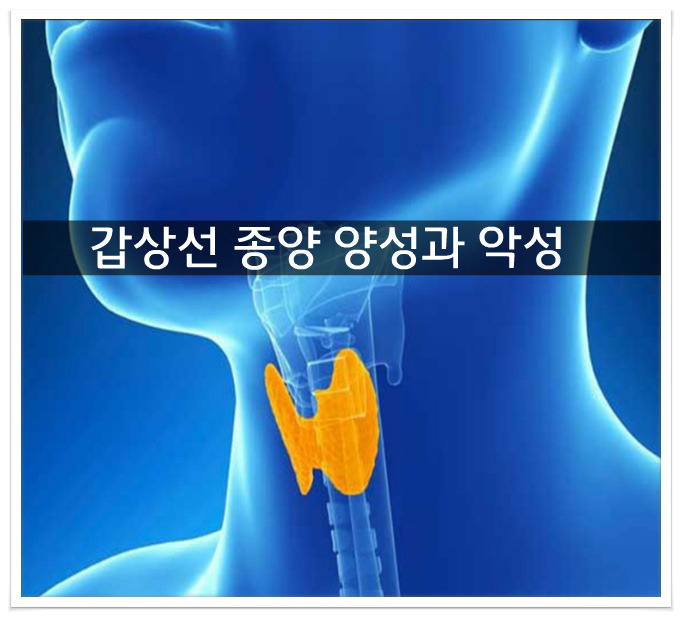 갑상선 종양 양성과 악성