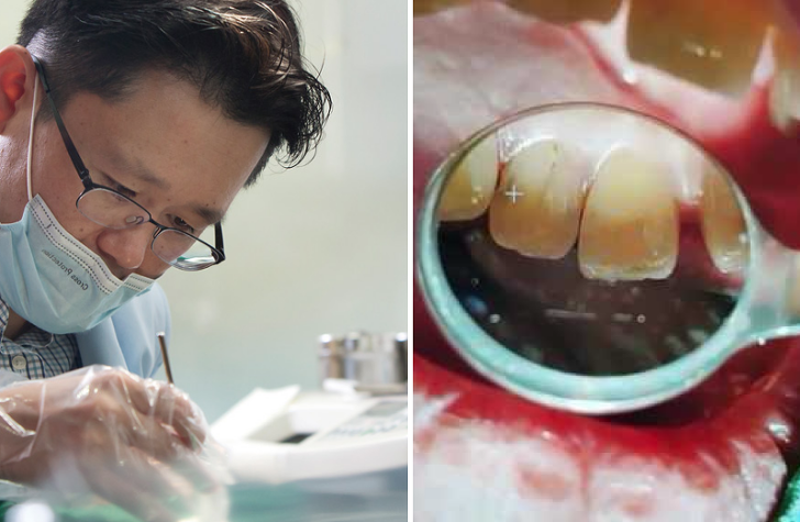 현역 치과의사가 폭로한 치과 바가지 요금의 진실
