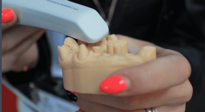 임플란트와 치아 교정의 차이점 이해