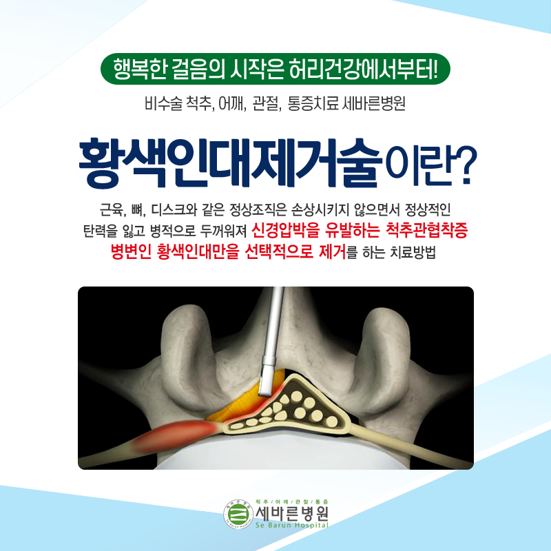척추관협착증 증상, 원인 그리고 치료방법 궁금