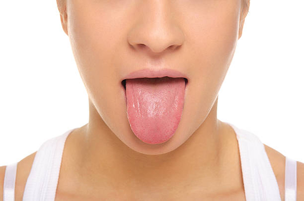 혀 안쪽 돌기 생기는 원인과 해결법