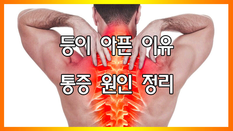 등이 아픈 이유, 등 통증 원인 정리