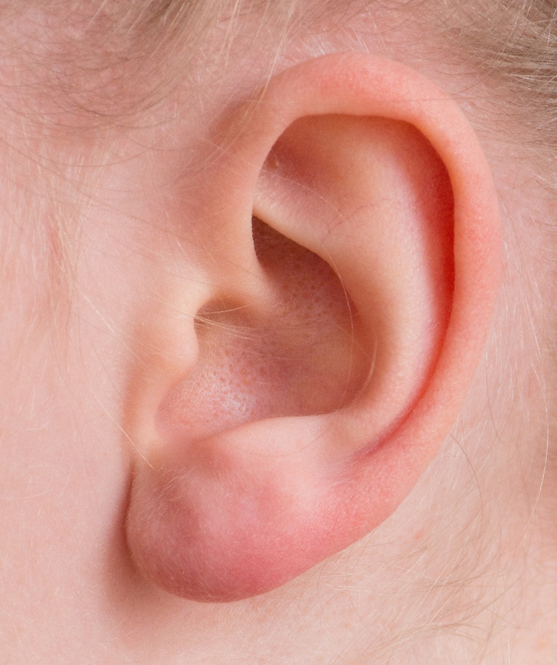 귀 건강의 중요성: 청력 관리와 예방법
