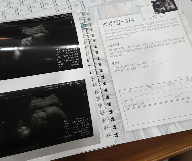 [엄마의 출산준비 2] 신생아 용품 리스트