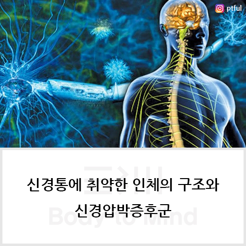 신경통(neuralgia)에 취약한 인체의 구조(body structure)와 신경압박증후군(nerve compression syndrome)