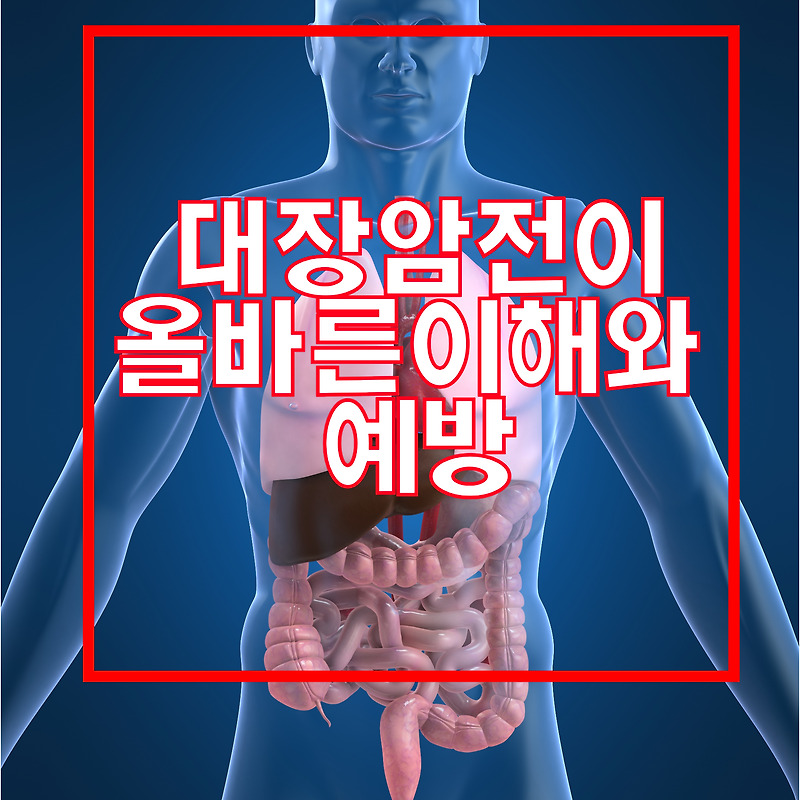 대장암전이(feat.알아두어야 할 중요한 사실들)