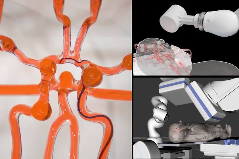 MIT, 뇌졸중 등 동맥류  치료 원격 로봇 시스템 개발 VIDEO:Joystick-operated robot could help surgeons treat stroke remotely