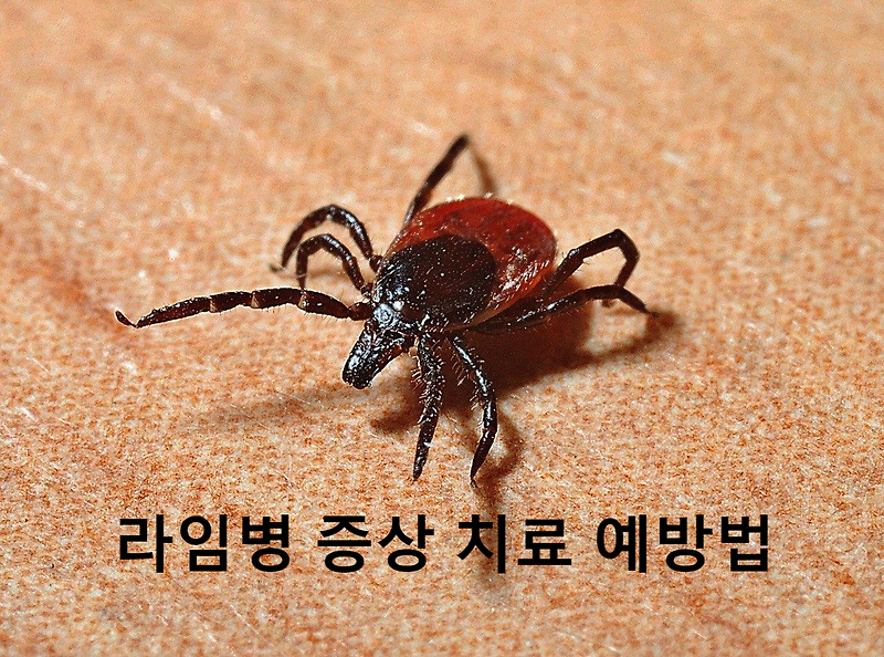 라임병 증상 치료 예방