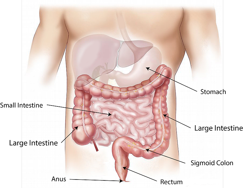 염증성 장질환 IBD - 크론병(Crohn's disease), 궤양성 대장염 (Ulcerative colitis)의 차이
