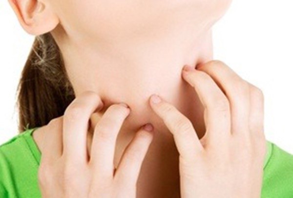 피부 가려움증 5가지 치료방법