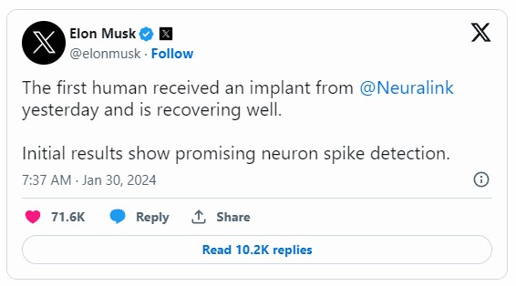 일론 머스크, 뉴럴링크(Neuralink)의 뇌 칩.. 인간에게 이식