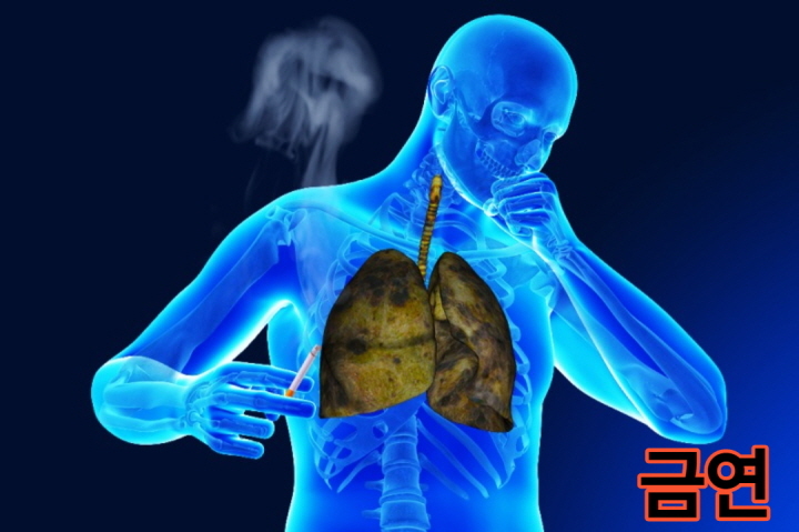 폐암의 증상과 예방법은?