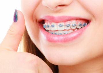 치아교정 비용 및 치아교정 종류